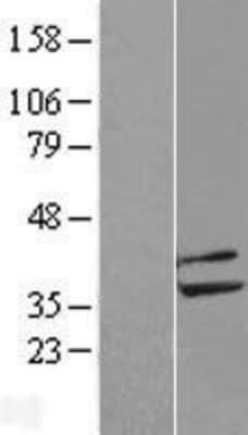 Western Blot: PPP2CB Overexpression Lysate [NBL1-14690]