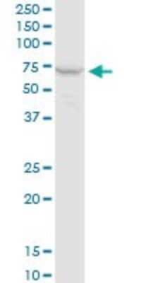 Western Blot: PPP2R1A Antibody (4E6) [H00005518-M02]