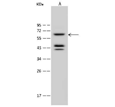 Western Blot: PPP2R1A Antibody [NBP2-99603]