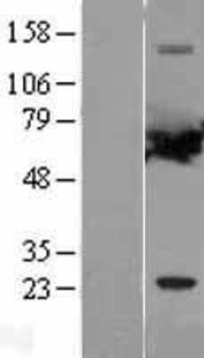 Western Blot: PPP2R1A Overexpression Lysate [NBL1-14692]