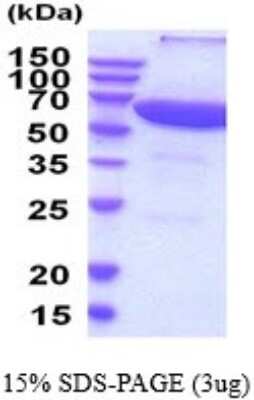 SDS-PAGE: Recombinant Human PPP2R1A His Protein [NBP2-52162]