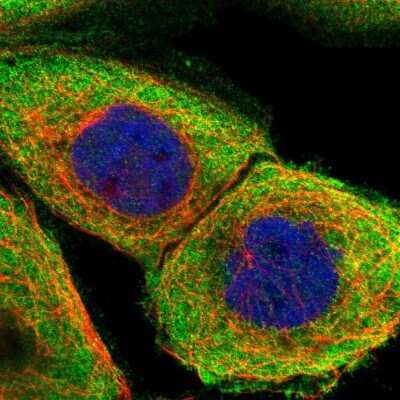Immunocytochemistry/ Immunofluorescence: PPP2R1B Antibody [NBP1-87251]