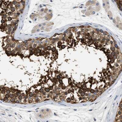 Immunohistochemistry-Paraffin: PPP2R1B Antibody [NBP1-87251]