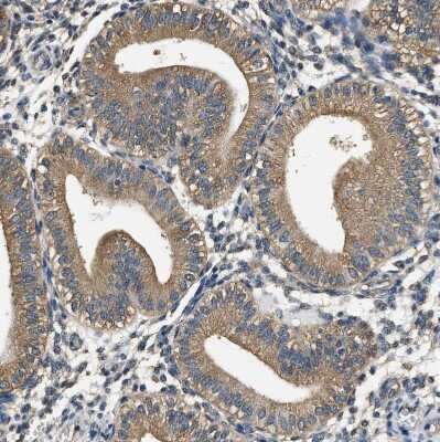 Immunohistochemistry-Paraffin: PPP2R1B Antibody [NBP1-87251]