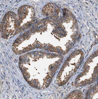 Immunohistochemistry-Paraffin: PPP2R1B Antibody [NBP1-87251]
