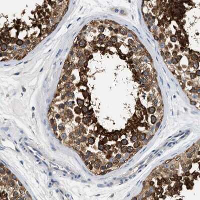 Immunohistochemistry-Paraffin: PPP2R1B Antibody [NBP1-87251]