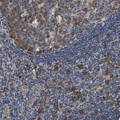Immunohistochemistry-Paraffin: PPP2R1B Antibody [NBP1-87251]