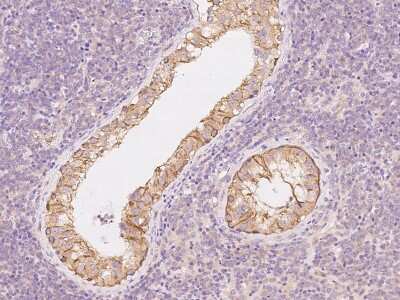 Immunohistochemistry-Paraffin: PPP2R1B Antibody [NBP2-97449]
