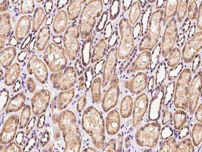 Immunohistochemistry-Paraffin: PPP2R1B Antibody [NBP2-99604]