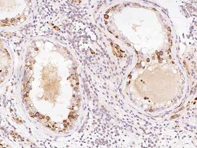 Immunohistochemistry-Paraffin: PPP2R1B Antibody [NBP2-99604]