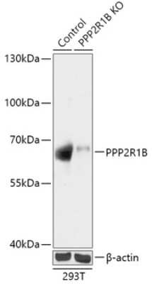 Knockout Validated: PPP2R1B Antibody - Azide and BSA Free [NBP3-03737]