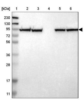 Western Blot: PPP2R1B Antibody [NBP1-87251]