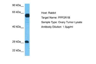 Western Blot: PPP2R1B Antibody [NBP2-85515]