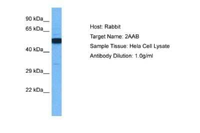 Western Blot: PPP2R1B Antibody [NBP2-85516]