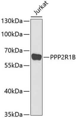 Western Blot: PPP2R1B AntibodyBSA Free [NBP2-94100]