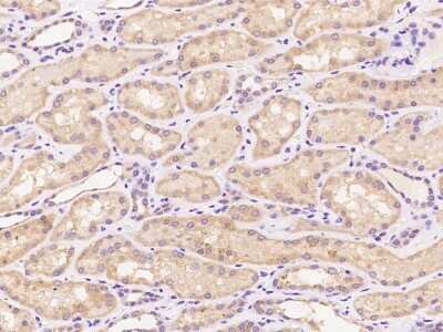 Immunohistochemistry: PPP2R2A Antibody [NBP3-06295]