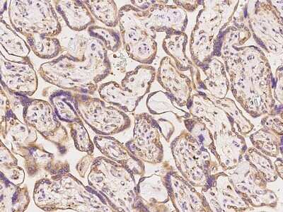 Immunohistochemistry: PPP2R2A Antibody [NBP3-06295]