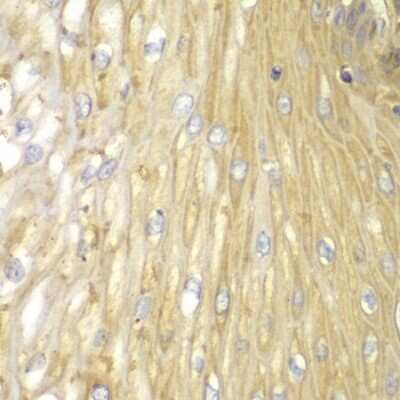Immunohistochemistry-Paraffin: PPP2R2A Antibody - BSA Free [NBP2-93798]