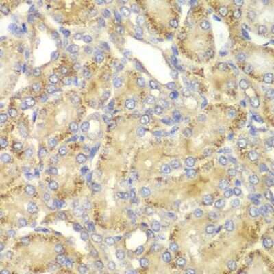 Immunohistochemistry-Paraffin: PPP2R2A Antibody - BSA Free [NBP2-93798]
