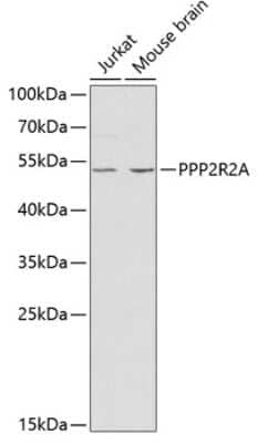 Western Blot: PPP2R2A AntibodyBSA Free [NBP2-93798]