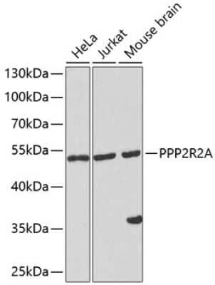 Western Blot: PPP2R2A AntibodyAzide and BSA Free [NBP3-04724]