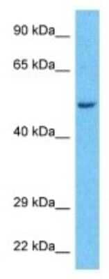 Western Blot: PPP2R2A Antibody [NBP3-09947]