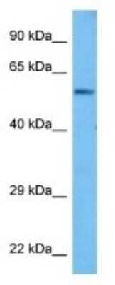 Western Blot: PPP2R2A Antibody [NBP3-11005]