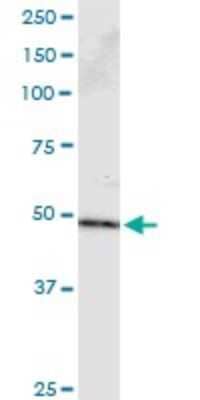 Immunoprecipitation: PPP2R2B Antibody (1B10) [H00005521-M23]