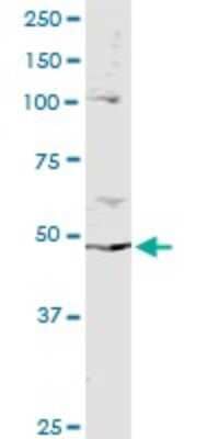 Immunoprecipitation: PPP2R2B Antibody (1F3) [H00005521-M02]