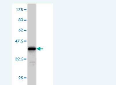 Western Blot: PPP2R2B Antibody (2C11) [H00005521-M01]