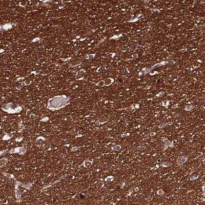 Immunohistochemistry-Paraffin: PPP2R2B Antibody [NBP2-46667]