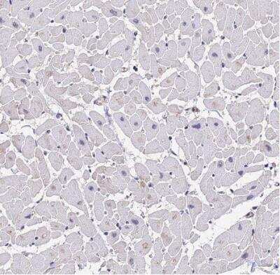 Immunohistochemistry-Paraffin: PPP2R2B Antibody [NBP2-46667]