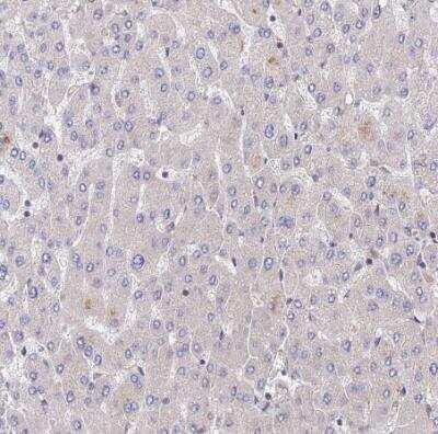 Immunohistochemistry-Paraffin: PPP2R2B Antibody [NBP2-46667]