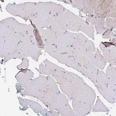 Immunohistochemistry-Paraffin: PPP2R2B Antibody [NBP2-46667]