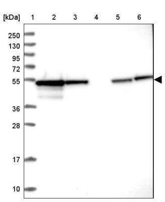 Western Blot: PPP2R2B Antibody [NBP2-46667]