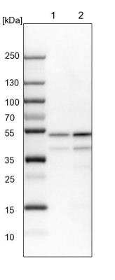 Western Blot: PPP2R2B Antibody [NBP2-46667]