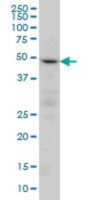Western Blot: PPP2R2C Antibody (6D1) [H00005522-M01]