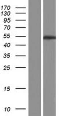 Western Blot: PPP2R2C Overexpression Lysate [NBP2-04872]