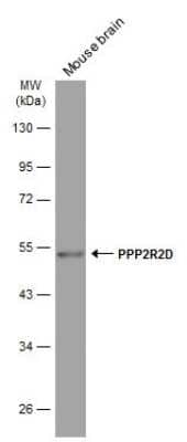 Western Blot: PPP2R2D Antibody (GT577) [NBP3-13614]