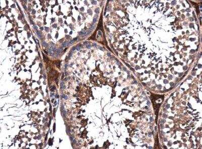 Immunohistochemistry-Paraffin: PPP2R2D Antibody [NBP2-15081]
