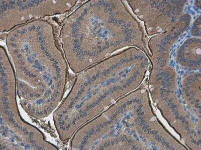 Immunohistochemistry-Paraffin: PPP2R2D Antibody [NBP2-15081]
