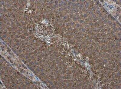 Immunohistochemistry-Paraffin: PPP2R2D Antibody [NBP2-15081]