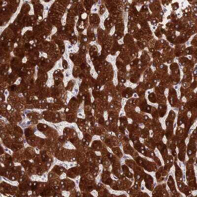 Immunohistochemistry-Paraffin: PPP2R2D Antibody [NBP2-33379]