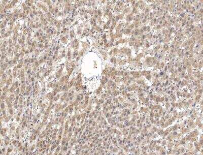 Immunohistochemistry-Paraffin: PPP2R2D Antibody [NBP3-12548]