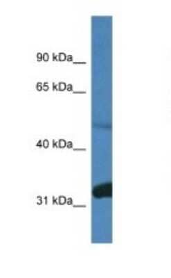 Western Blot: PPP2R2D Antibody [NBP1-74170]