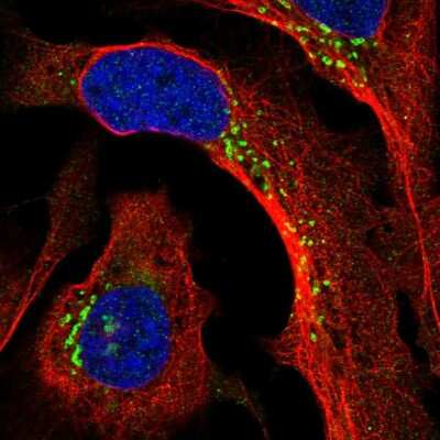 Immunocytochemistry/ Immunofluorescence: PPP2R3A Antibody [NBP2-55833]