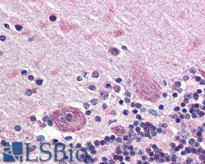 Immunohistochemistry-Paraffin: PPP2R3A Antibody [NB100-93429]