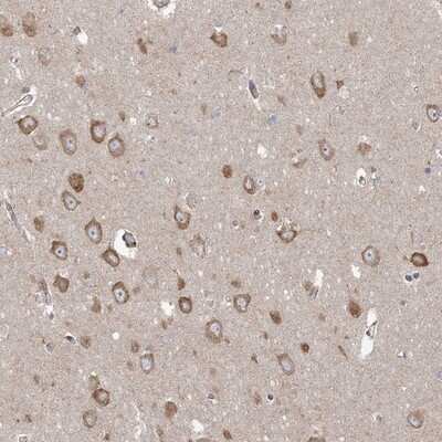 Immunohistochemistry-Paraffin: PPP2R3A Antibody [NBP1-87233]