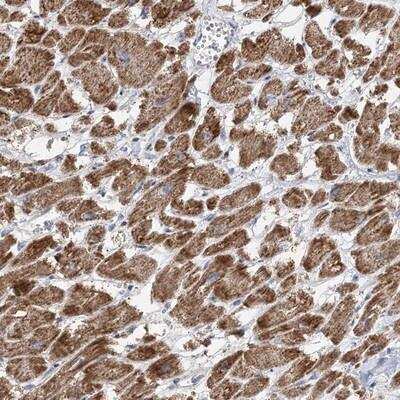 Immunohistochemistry-Paraffin: PPP2R3A Antibody [NBP1-87234]