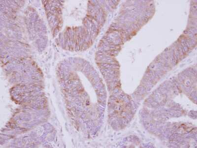 Immunohistochemistry-Paraffin: PPP2R3A Antibody [NBP2-19908]